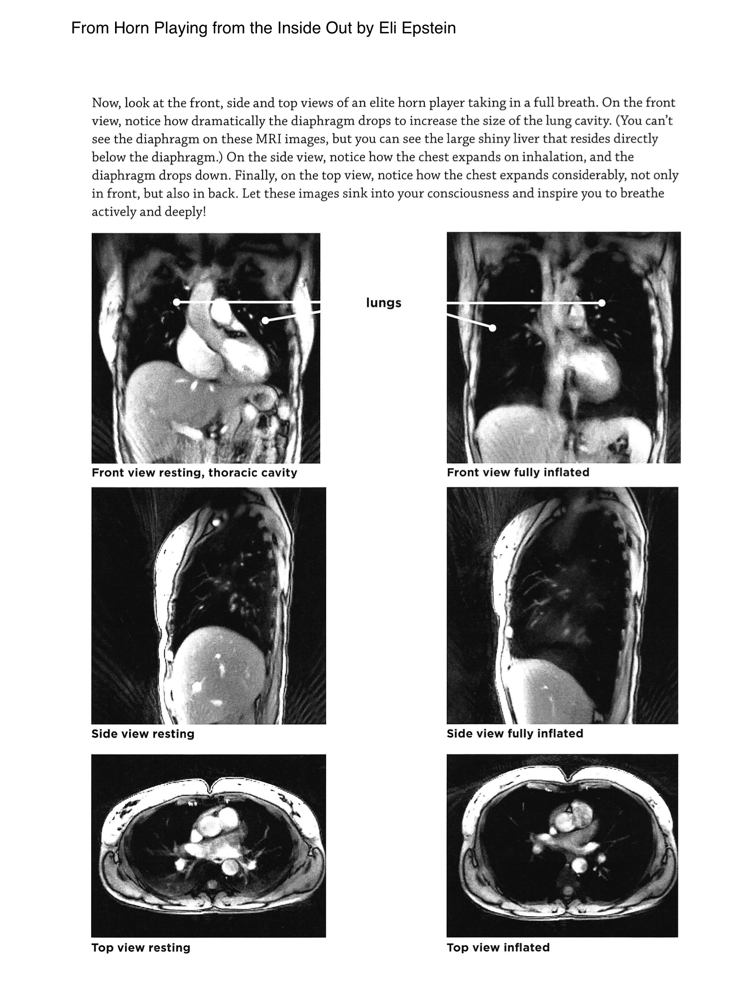 MRI views from Horn Playing from the Inside Out by Eli Epstein, showing front, side, and top views of a horn player's thoracic cavity at rest and fully inflated