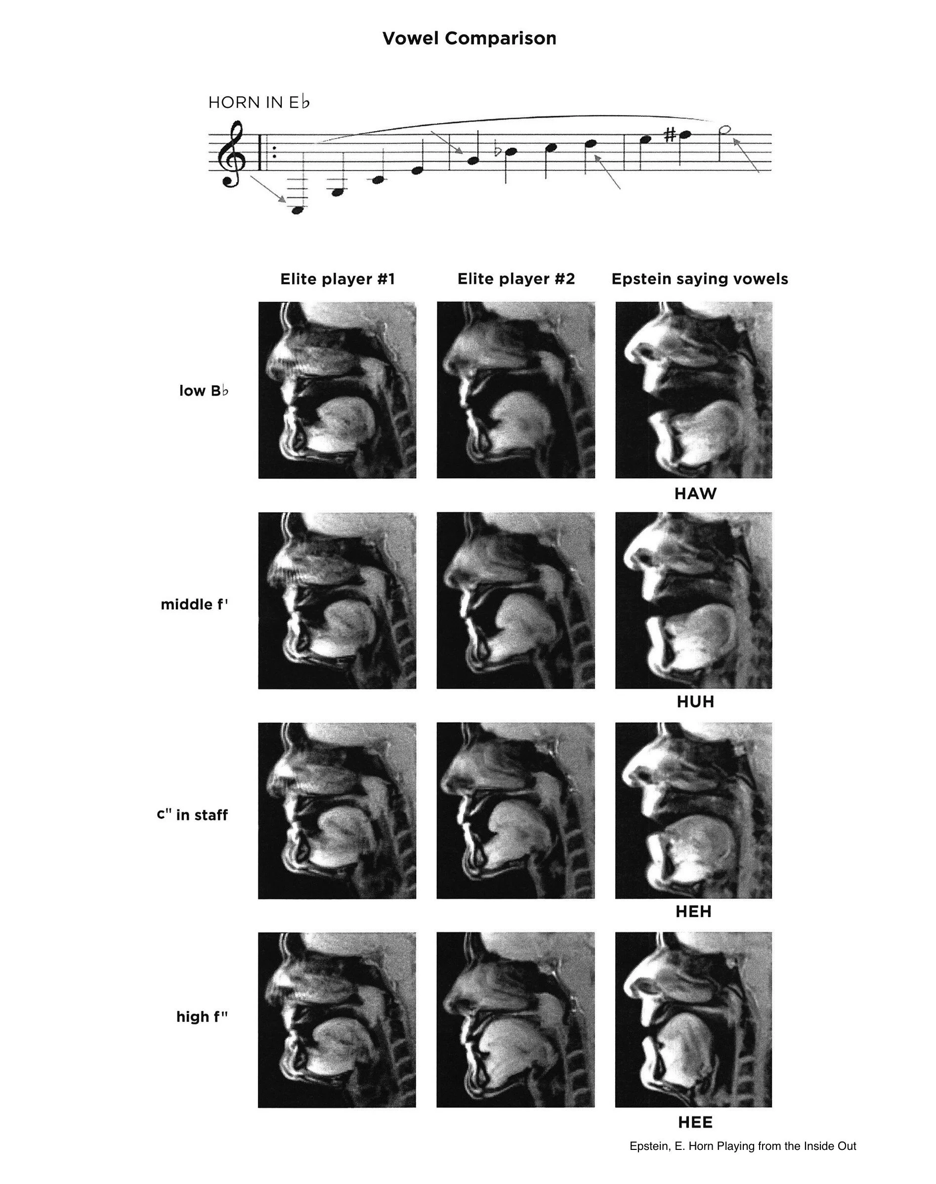 MRI vowel comparison grid showing two elite horn players and vowel shapes (HAW, HUH, HEH, HEE) at four pitch registers